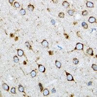 Anti-UBCH5 Antibody