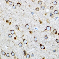 UBE2D1 antibody