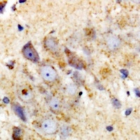 UBE2L3 antibody