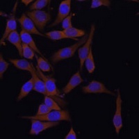 Anti-UBCH7 Antibody