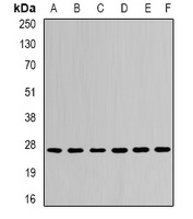 CDC34B Antibody