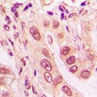 Anti-UBE2Z Antibody