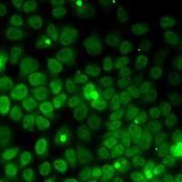 Anti-UFD1L Antibody