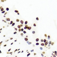 Anti-USF1 Antibody