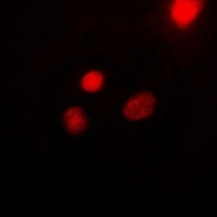 Anti-USF1 Antibody