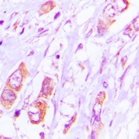 Anti-LTAP Antibody
