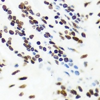 Anti-VRK1 Antibody