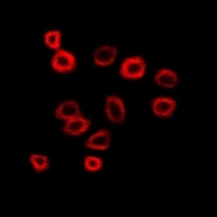 Anti-N-WASP Antibody