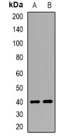 WIF-1 Rabbit Polyclonal Antibody