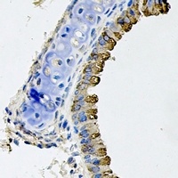 Anti-WNT5B Antibody