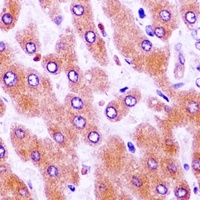 Anti-Wilms Tumor 1 Antibody