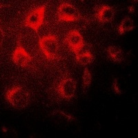Anti-Wilms Tumor 1 Antibody