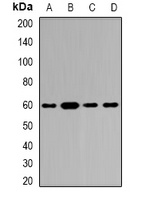Tyrosyl-tRNA Synthetase Rabbit Polyclonal Antibody