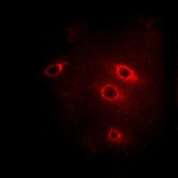 Anti-14-3-3 beta Antibody