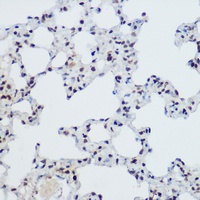 Anti-ZNF145 Antibody