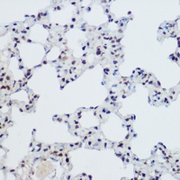 ZBTB16 antibody