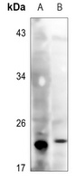 Glutathione Peroxidase Rabbit Polyclonal Antibody
