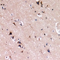 Anti-Nephrin Antibody