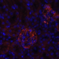 Anti-Nephrin Antibody