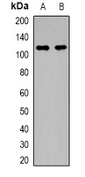 MYPT1 (Phospho-T696) Antibody