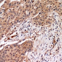 Anti-MYPT1 (Phospho-T696) Antibody
