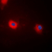 Anti-MYPT1 (Phospho-T696) Antibody