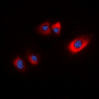 HSPB6 antibody