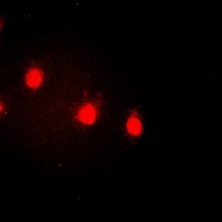 Anti-Cyclin E1 (Phospho-T77) Antibody