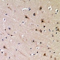 Anti-DDX3X (Phospho-T322) Antibody