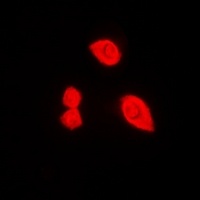 Anti-DDX3X (Phospho-T322) Antibody