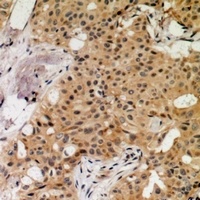 Anti-MNK1 (Phospho-T250) Antibody
