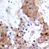 Anti-FOXO1/3 Antibody