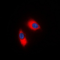 Anti-p47 phox Antibody