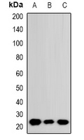 RhoGDI alpha Rabbit Polyclonal Antibody
