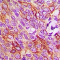 Anti-TMEM16J Antibody