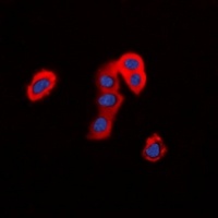 Anti-TMEM16J Antibody