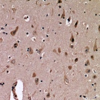 Anti-MUC1 Antibody