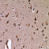 MUC1 antibody