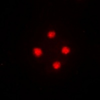 Anti-SRSF5 Antibody