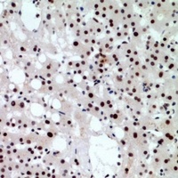Anti-CHD4 Antibody