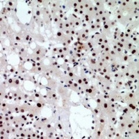 CHD4 antibody