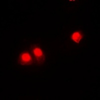 Anti-CHD4 Antibody