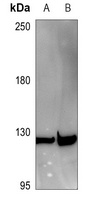 Tensin 3 Rabbit Polyclonal Antibody