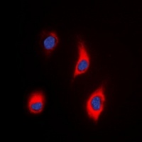 TNS3 antibody