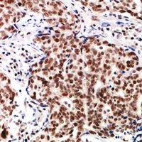 Anti-TP53INP2 Antibody