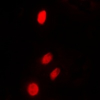 Anti-TP53INP2 Antibody