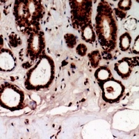 Anti-TSHZ2 Antibody