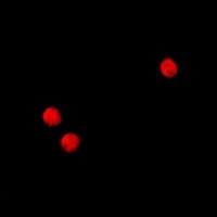 TSHZ2 antibody