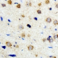 Anti-ICK Antibody