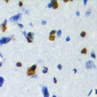 Anti-ZFP95 Antibody
